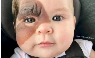 The baby was given birth to to differently and has made her remain unique while some people been criticizing her look forgetting she's a baby and created equally as they ... SEE MORE